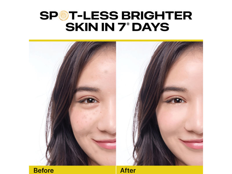Bright Glow Vitamin C Serum