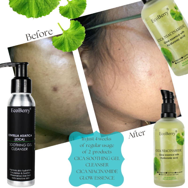 Cica Niacinamide Glow Essence with Hyaluronic Acid