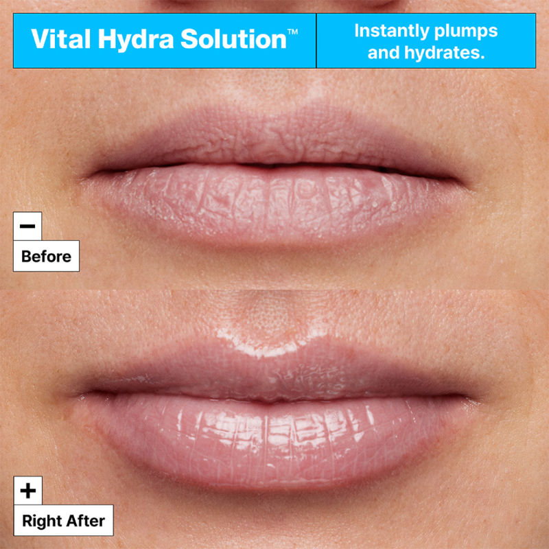 Vital Hydra Solution Hydrating Lip Mask With Hyaluronic Acid – Leave-On Lip Balm