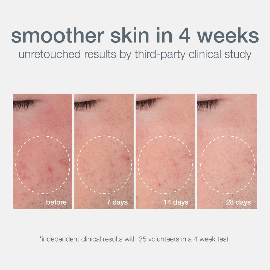 Daily Microfoliant Face Scrub Mini With Salicylic Acid, Rice Bran & Papain Enzymes