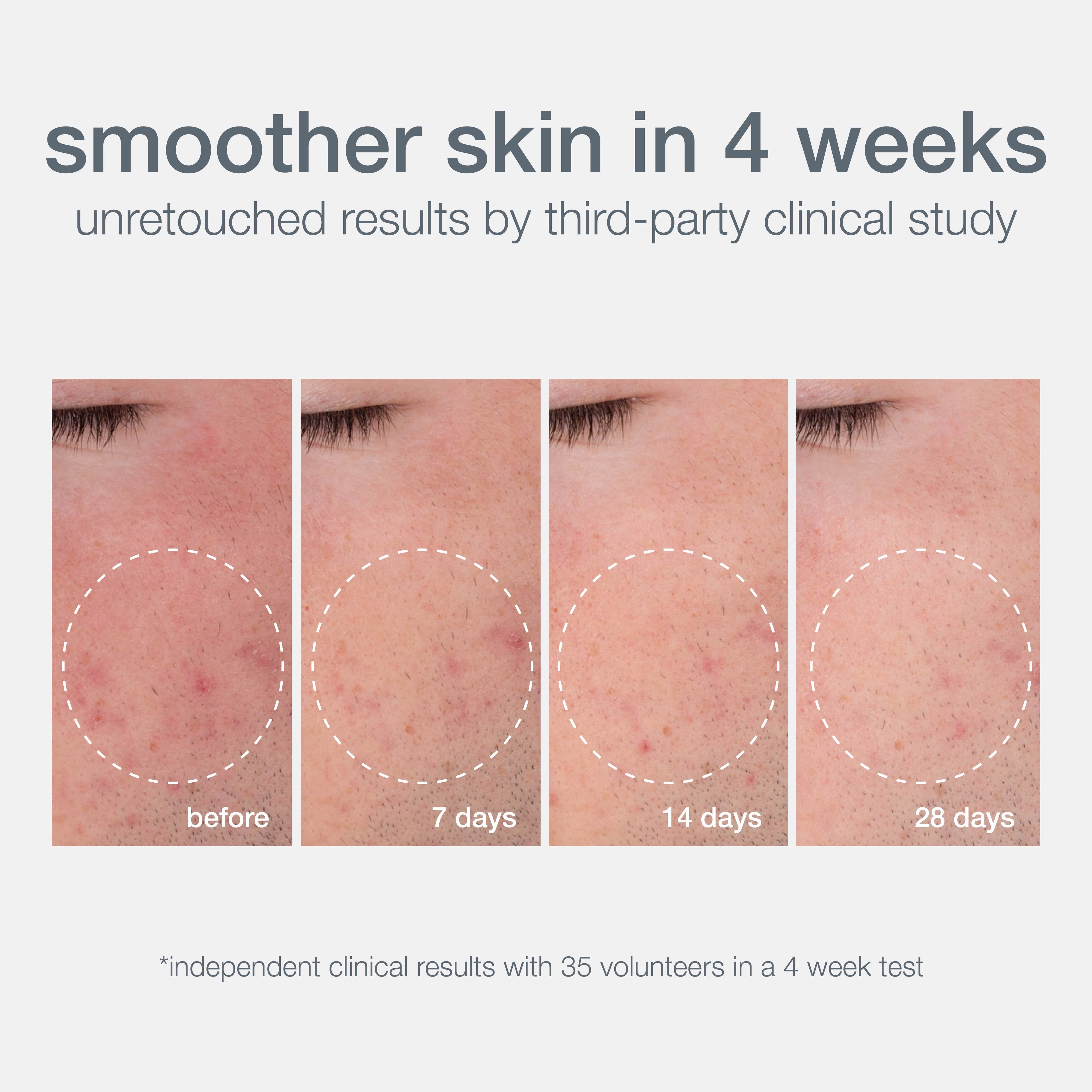 Daily Microfoliant Face Scrub Mini With Salicylic Acid, Rice Bran & Papain Enzymes