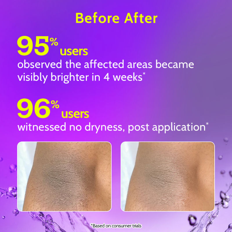 Vitamin C Neck Knee Elbow Brightening Roll On for Men & Women