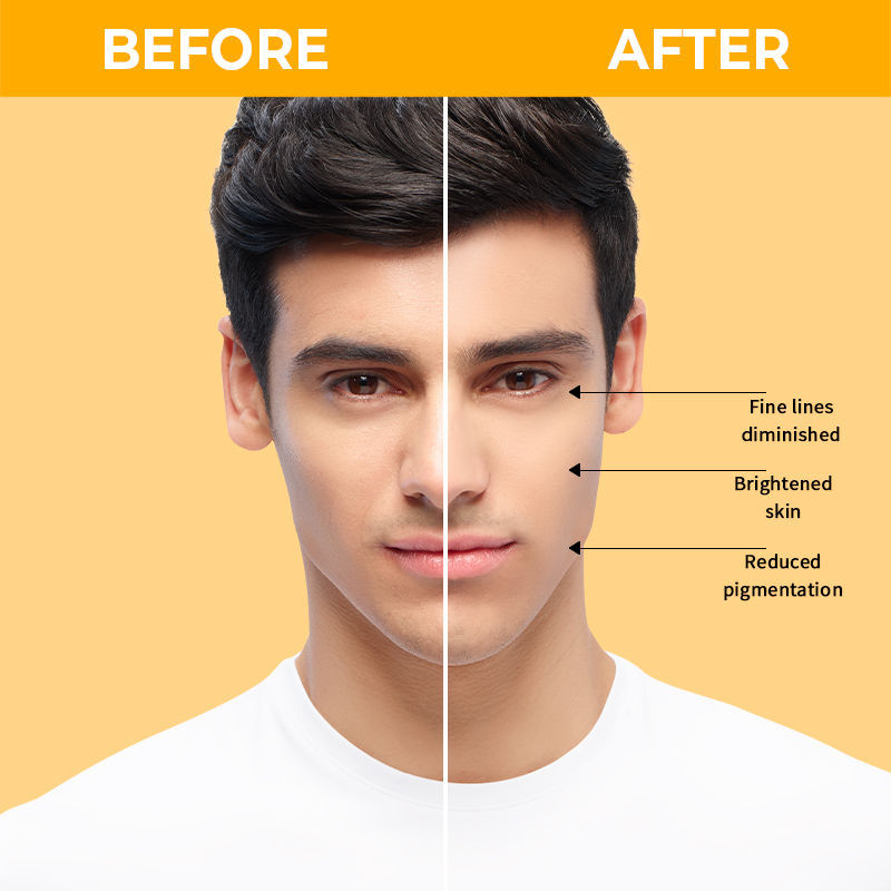 Nykaa SkinRX 20% Vitamin C + 1% Hyaluronic Acid Serum for Bright, Radiant and Hydrated Skin