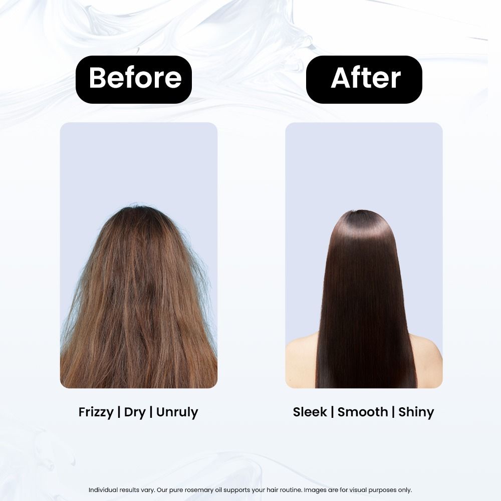 100% Pure Rosemary Essential Oil For Hair Growth, Hair Thickening & Hair Fall Control
