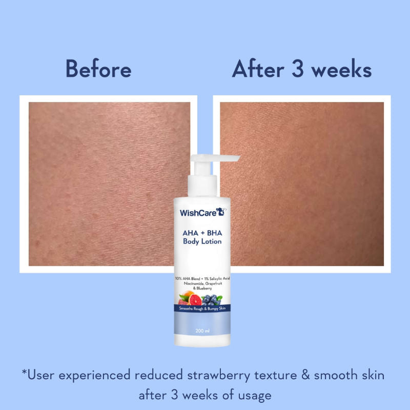 AHA + BHA Exfoliating Body Lotion for Strawberry Skin-Provides Deep Hydration & Detan Skin