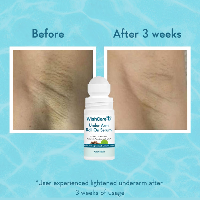 Aqua Fresh Underarm Roll On Serum-Reduces Pigmentation,Brightens Skin & Prevents Body Odour