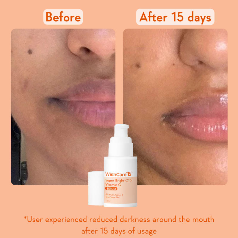 Super Bright C16 Vitamin C Face Serum for Glowing Skin- Reduces Pigmentation & Dark Spots