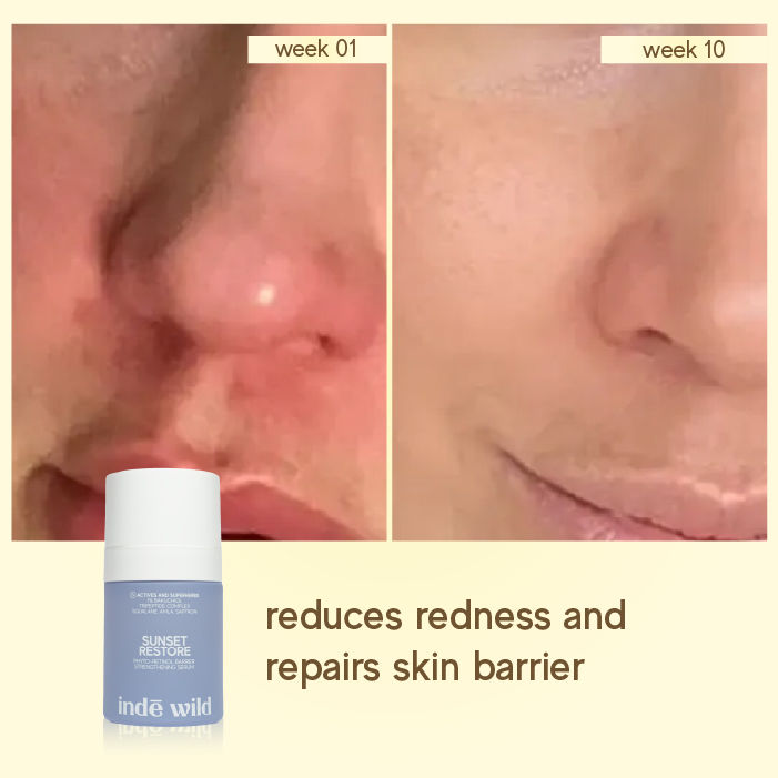 Sunset Restore 1% Bakuchiol Serum