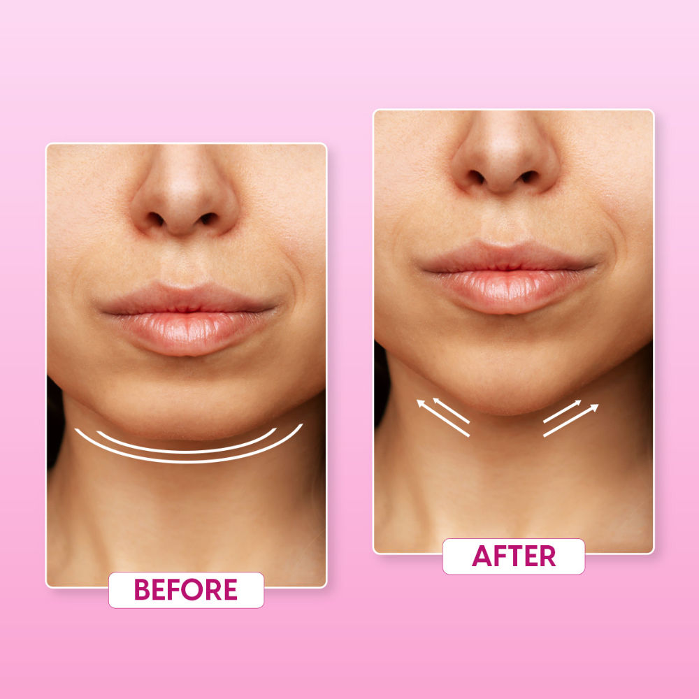 V Line Face Slimming Belt Double Chin Reducer Jawline Shaper Mask for Skin Tightening