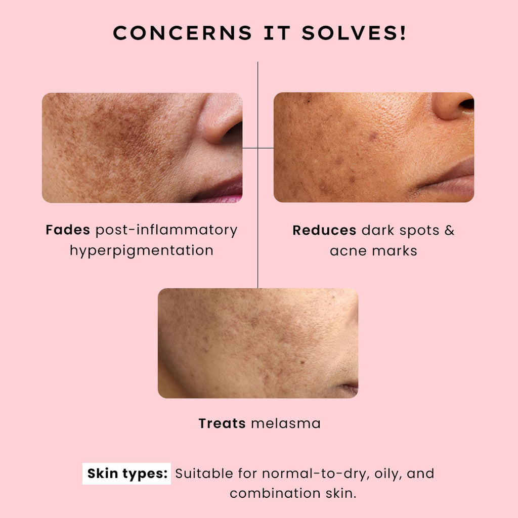 Biphasic Advanced De-Pigmentation Serum, Correct & Prevent Pigmentation In-Vivo Tested