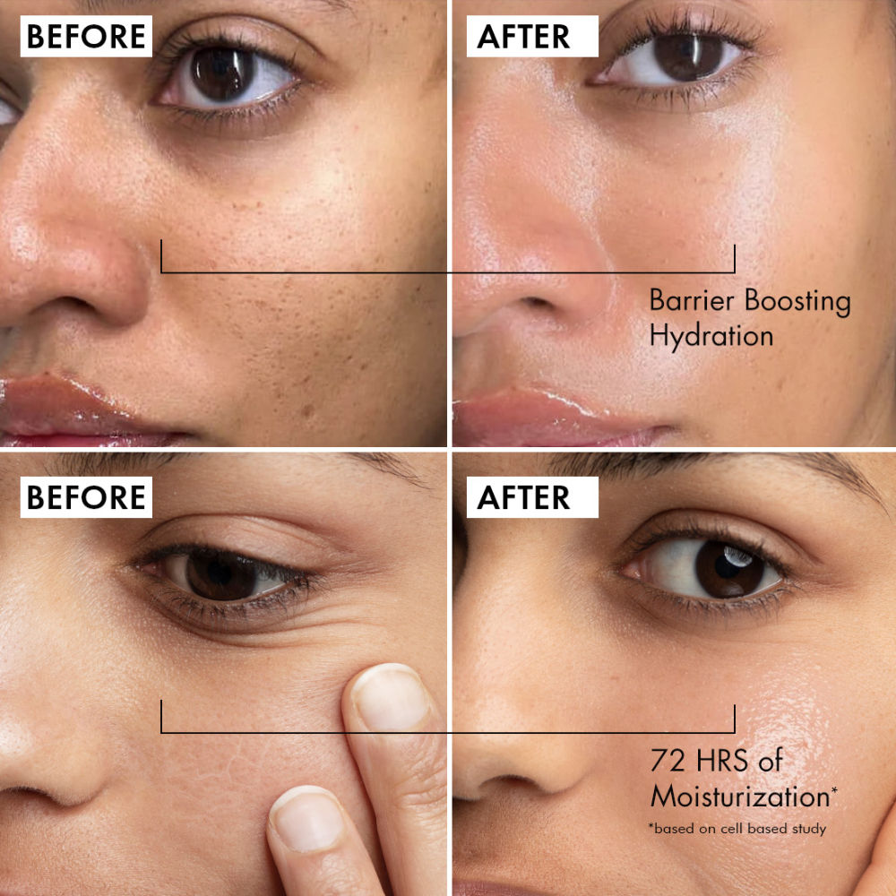 Oil-Free Coffee Face Moisturizer Gel with Hyaluronic Acid & Pro-Vit B5 for Deep Hydration