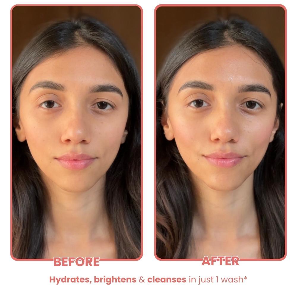 Watermelon Hyaluronic + Salicylic Acid Face Wash for Dull, Dry & Oily Skin