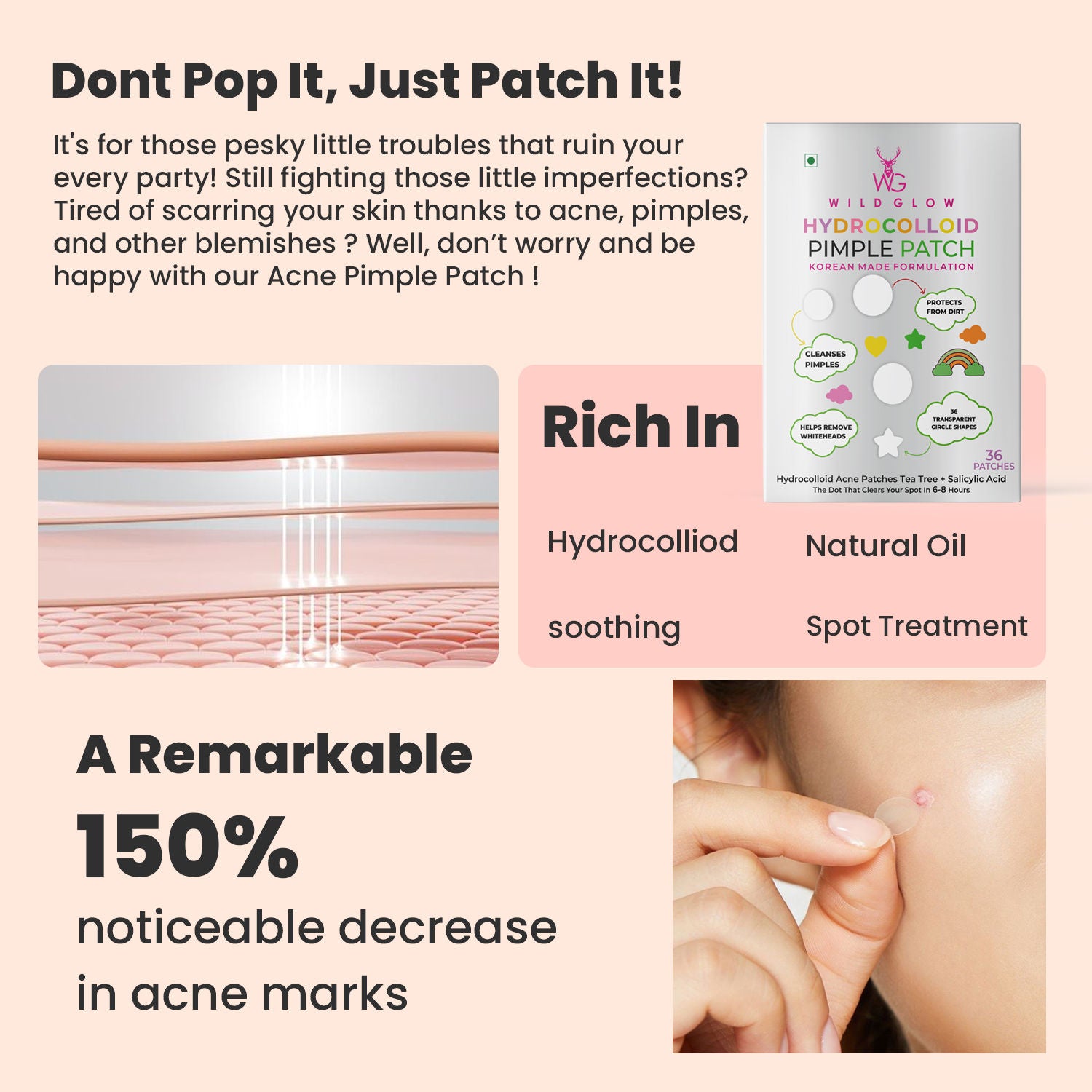 Acne Pimple Patches