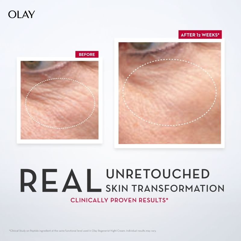 Regenerist Micro Sculpting Serum, Plump & Bouncy Skin, With Hyaluronic Acid & Niacinamide