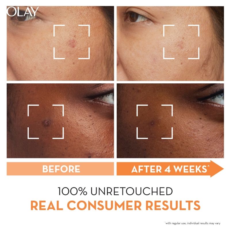 Luminous Niacinamide Vitamin C Moisturiser