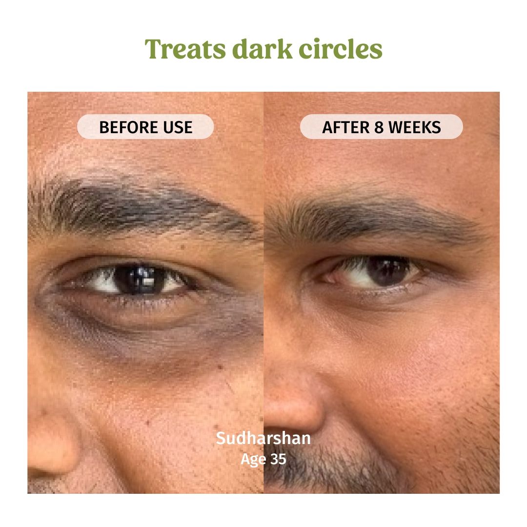 Under Eye Cream For Puffiness & Dark Circles Control With Bamboo & Goji Berry