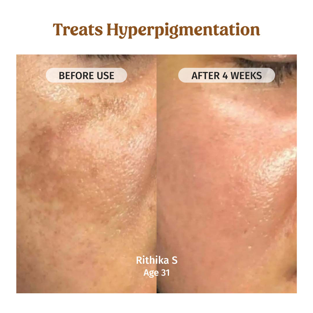 Milk Drops Skin Brightening Serum With Rice Milk, Marine Algae Extract & Alpha-Arbutin