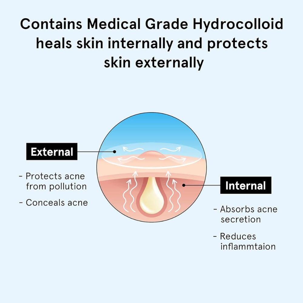 Hydrocolloid Acne Pimple Patch Absorbs & Flattens Acne Overnight