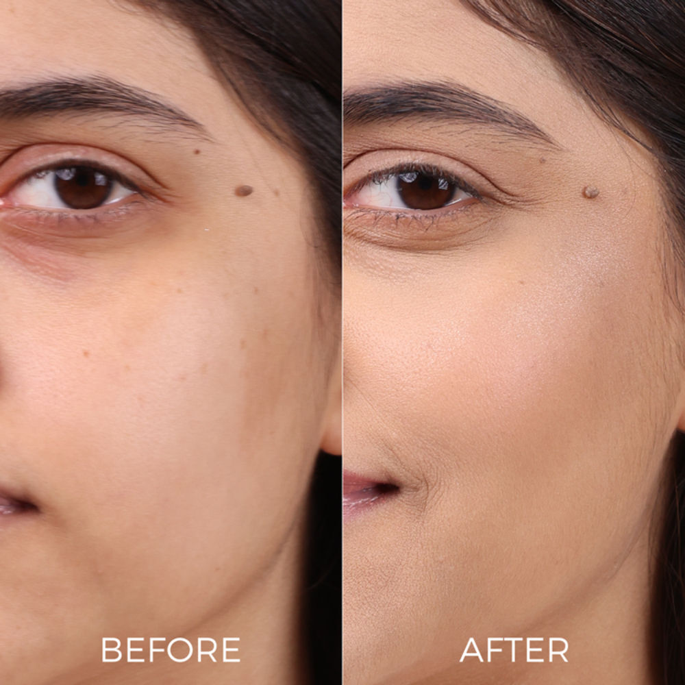 Professional Age Revival Moisturizer | Anti-Aging Moisturizer for Wrinkles & Fine Lines