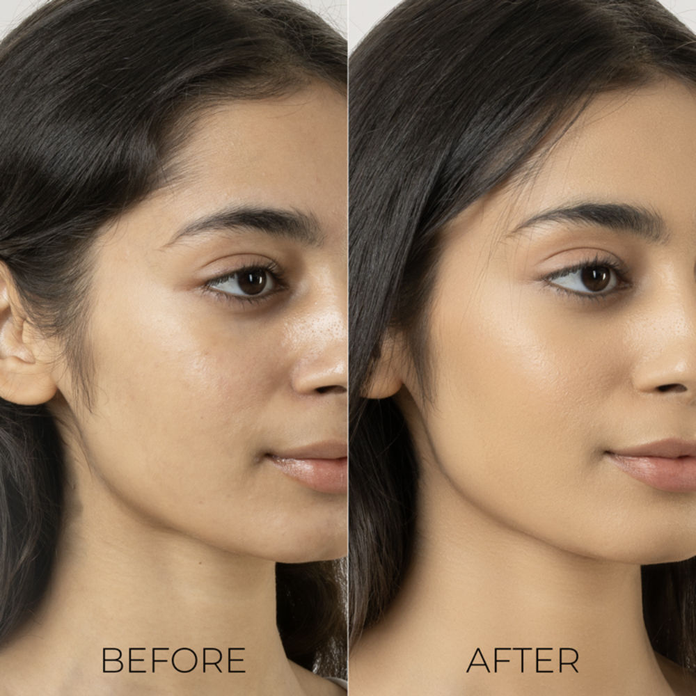 Oil Away Serum Mist For Oily & Acne Prone Skin