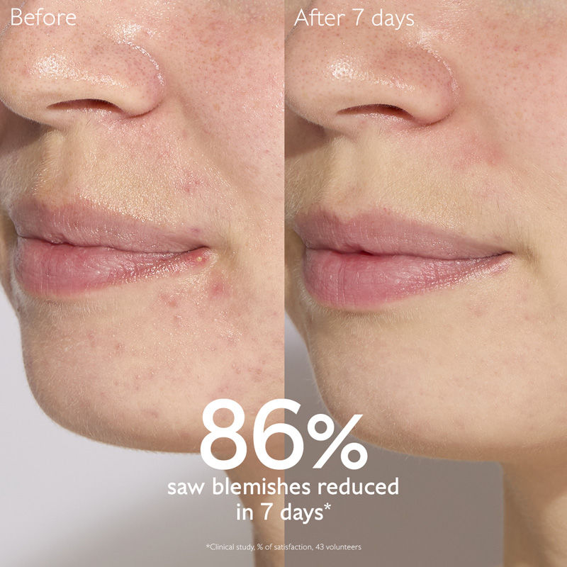 Vinopure Blemish Control Salicylic Serum