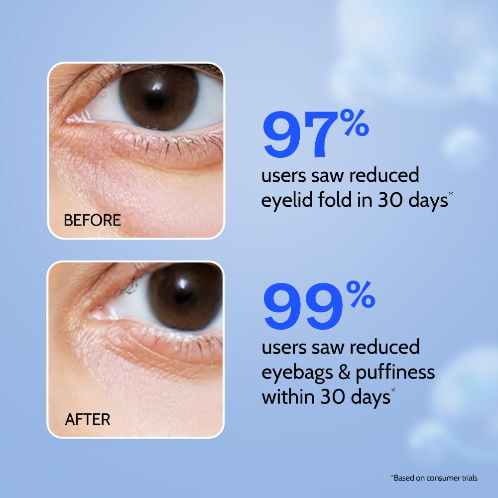 Hydrating & Anti Aging Under Eye Cream for Dark Circles & Puffiness