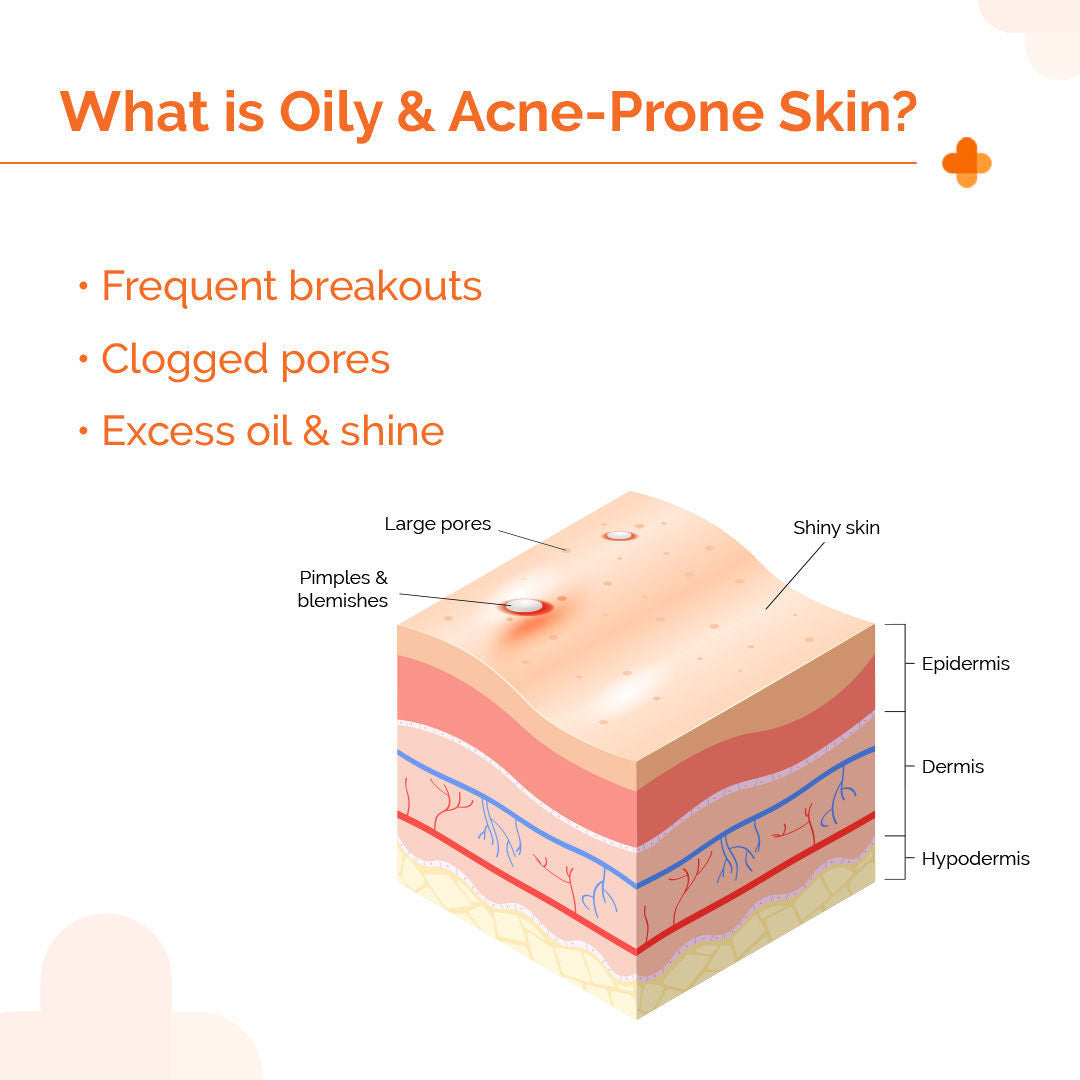 1% Hyaluronic Sunscreen Oil-Free Gel With SPF 50 PA++++ For Oily In-Vivo tested
