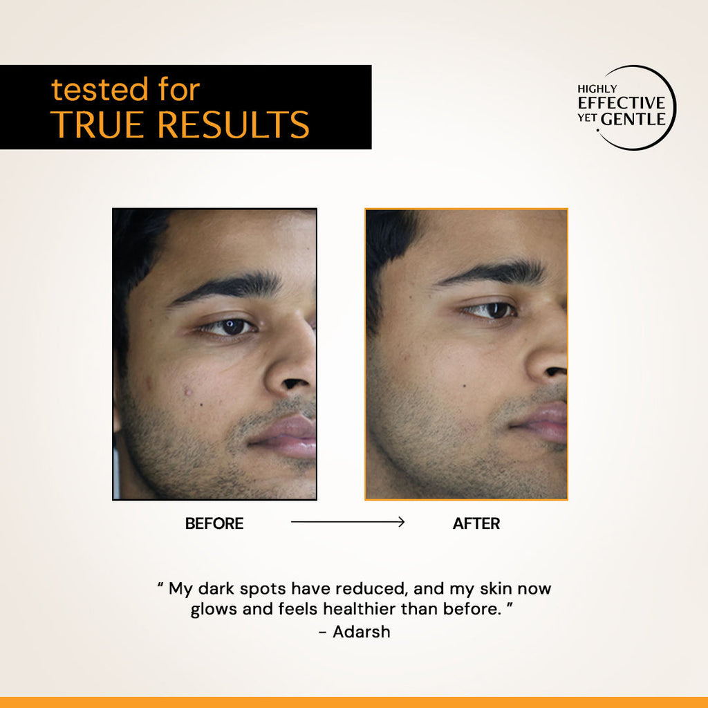 10% Vitamin C Face Serum with 0.5% Ferulic Acid, for Glowing Skin, Beginner-friendly
