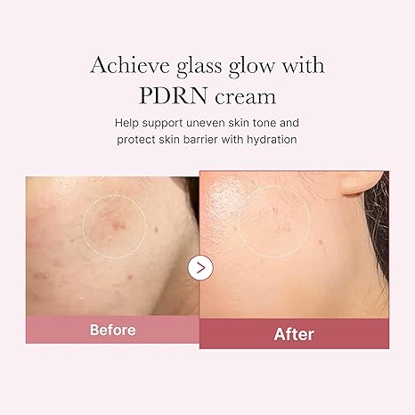 PDRN Pink Hyaluronic Moisturizing Cream