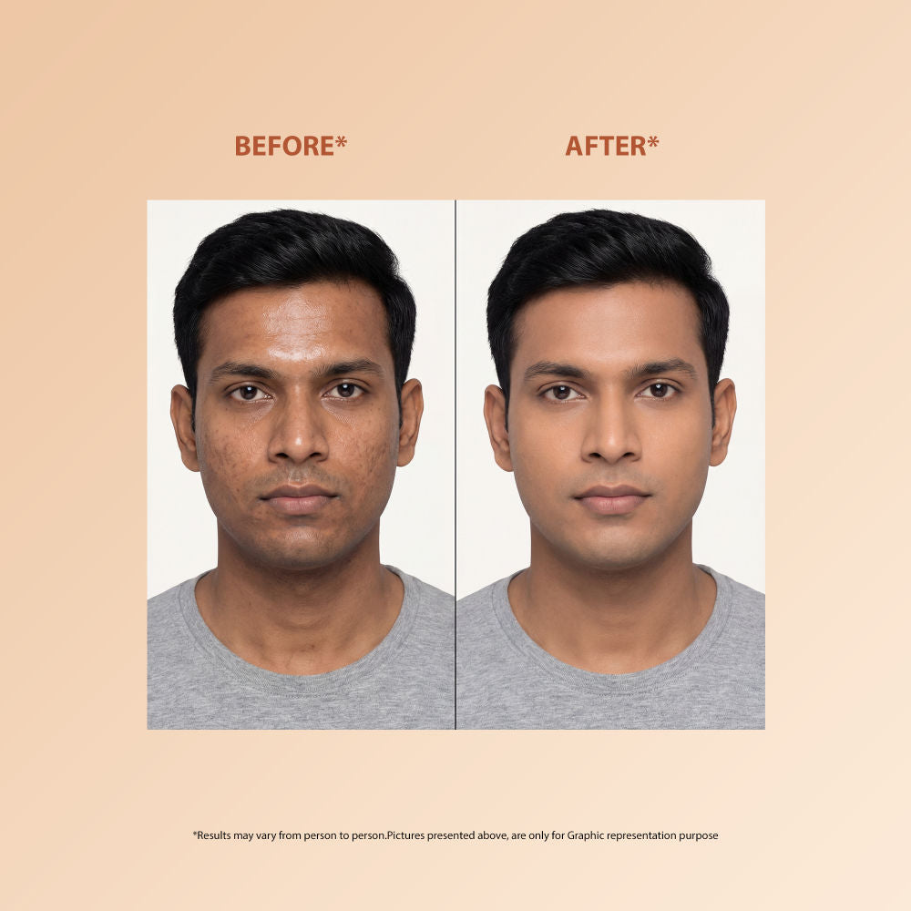 Skin Perfecting Niacinamide Serum