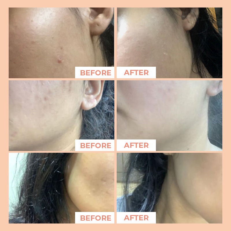 Ethereal Rosehip Brightening Face Oil