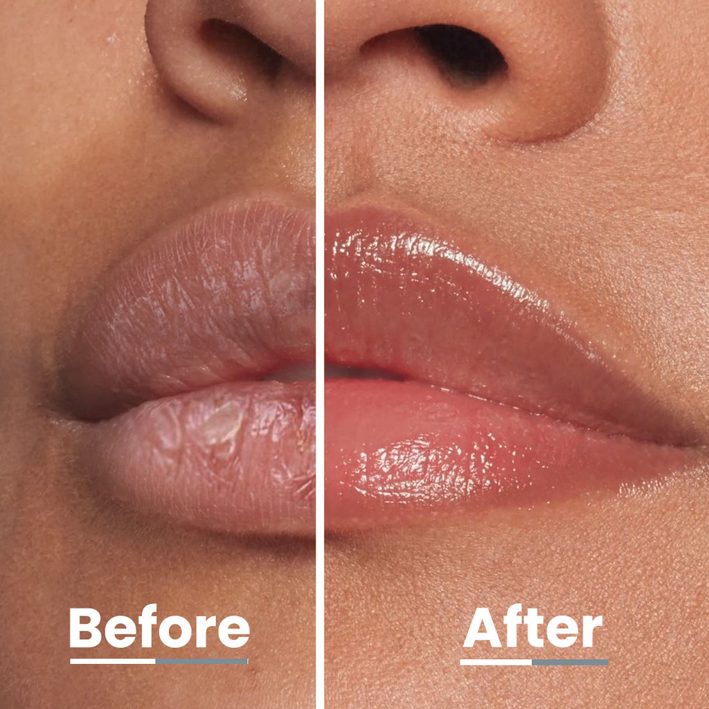 Vitamin Infused Peptide Lip Balm - Vanilla For Dry & Chapped Lips, Hydrates & Moisturizes