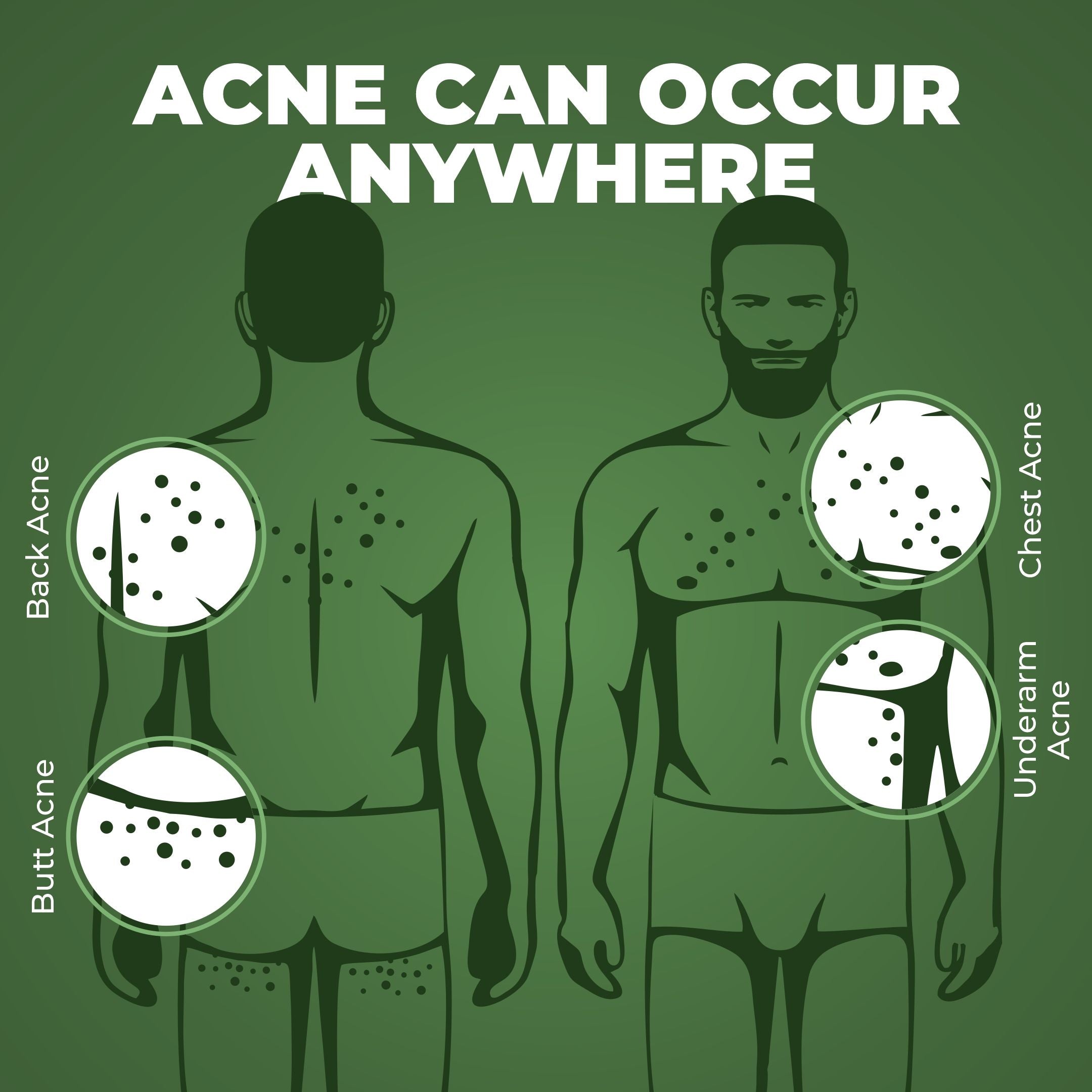 B-Acne Clear Bodywash