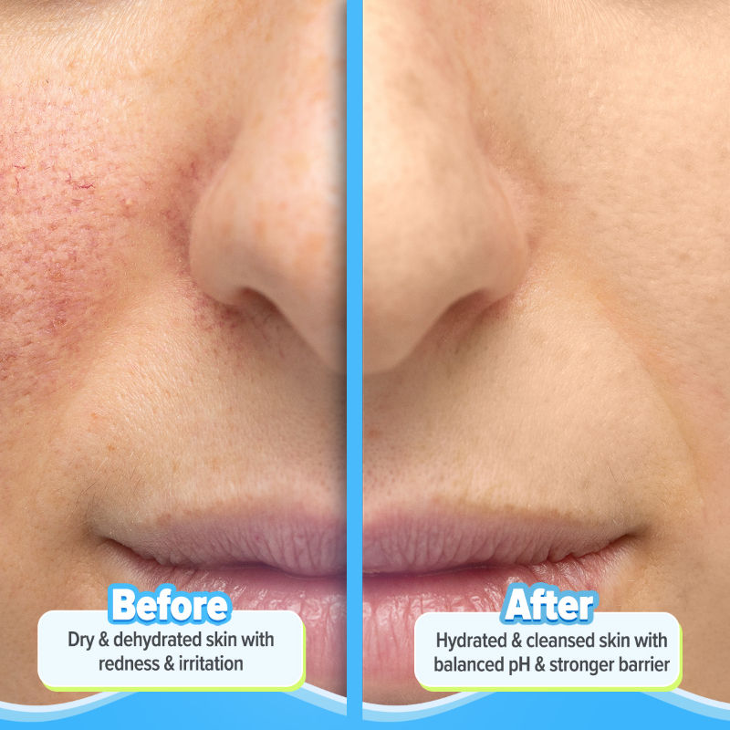 5 Barrier + Repair Gentle Cleanser