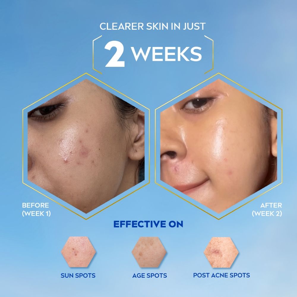 Luminous Even Glow Oil Control Day Cream Spf 50,Thiamidol Uv Protection & Reduces Dark Spots