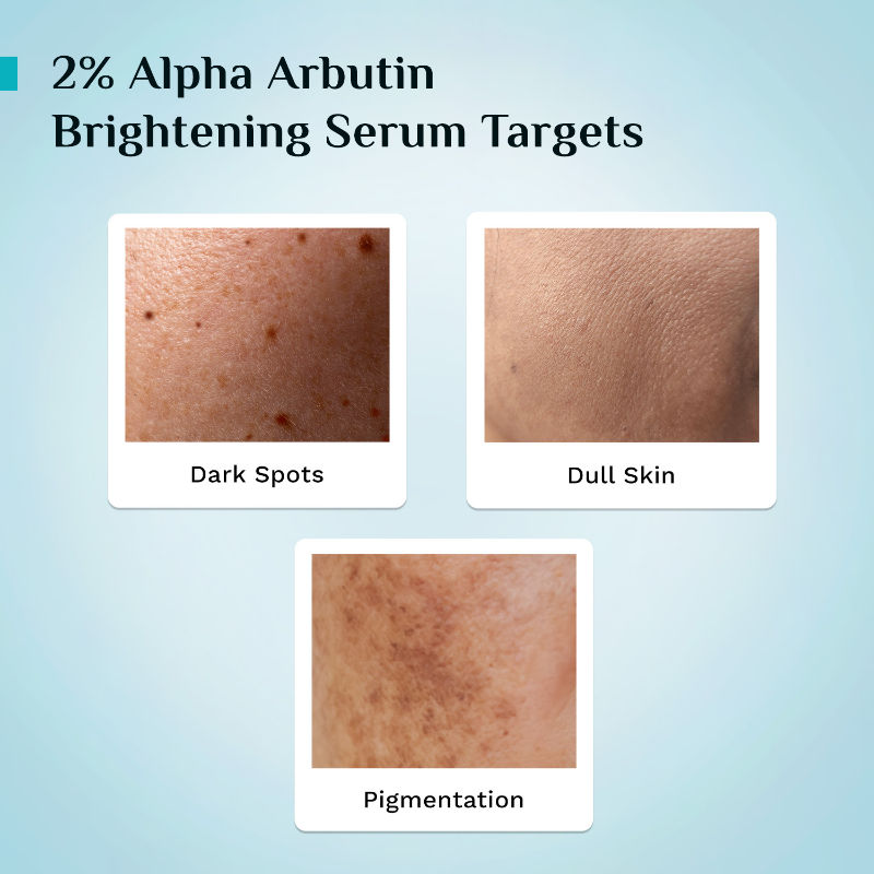 2% Alpha Arbutin & 3% Vitamin C Brightening Serum, Fades Pigmentation & Brightens Skin