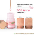 Overnight Acne Spot Corrector