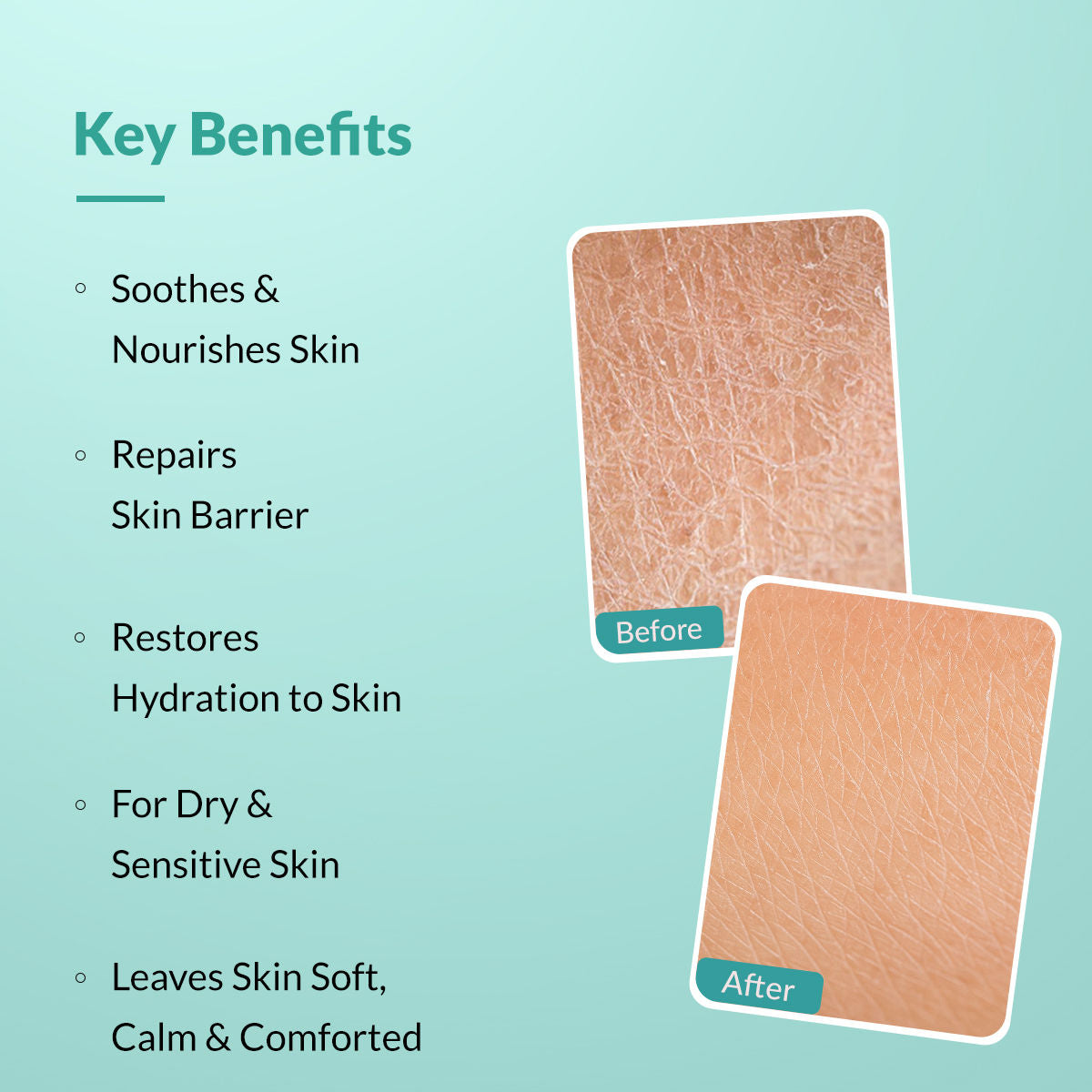 Dewrav Body Lotion For Dry & Sensitive Skin With Shea Butter & Ceramides Complex