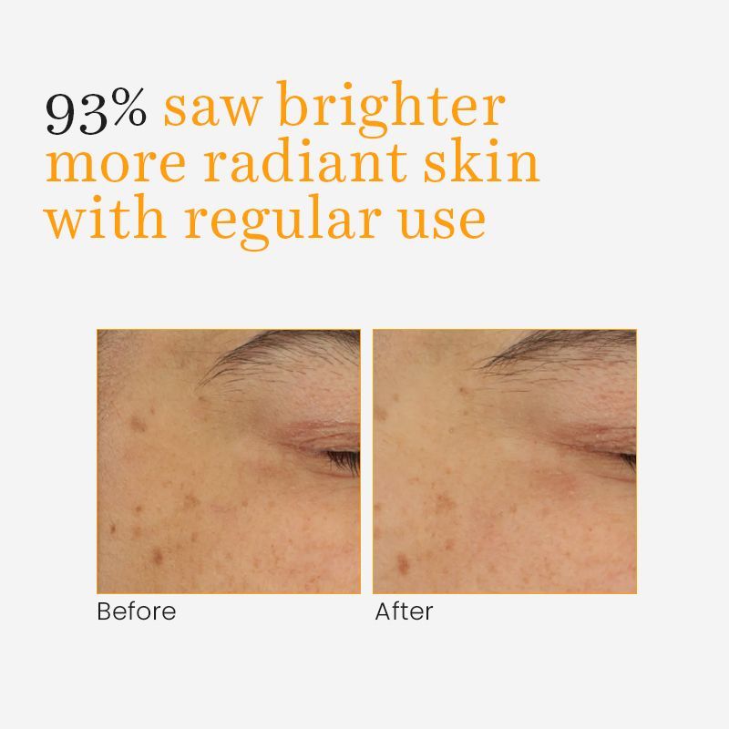 Vitamin- C & Turmeric Gel Cream For Glow And Moisturised Skin