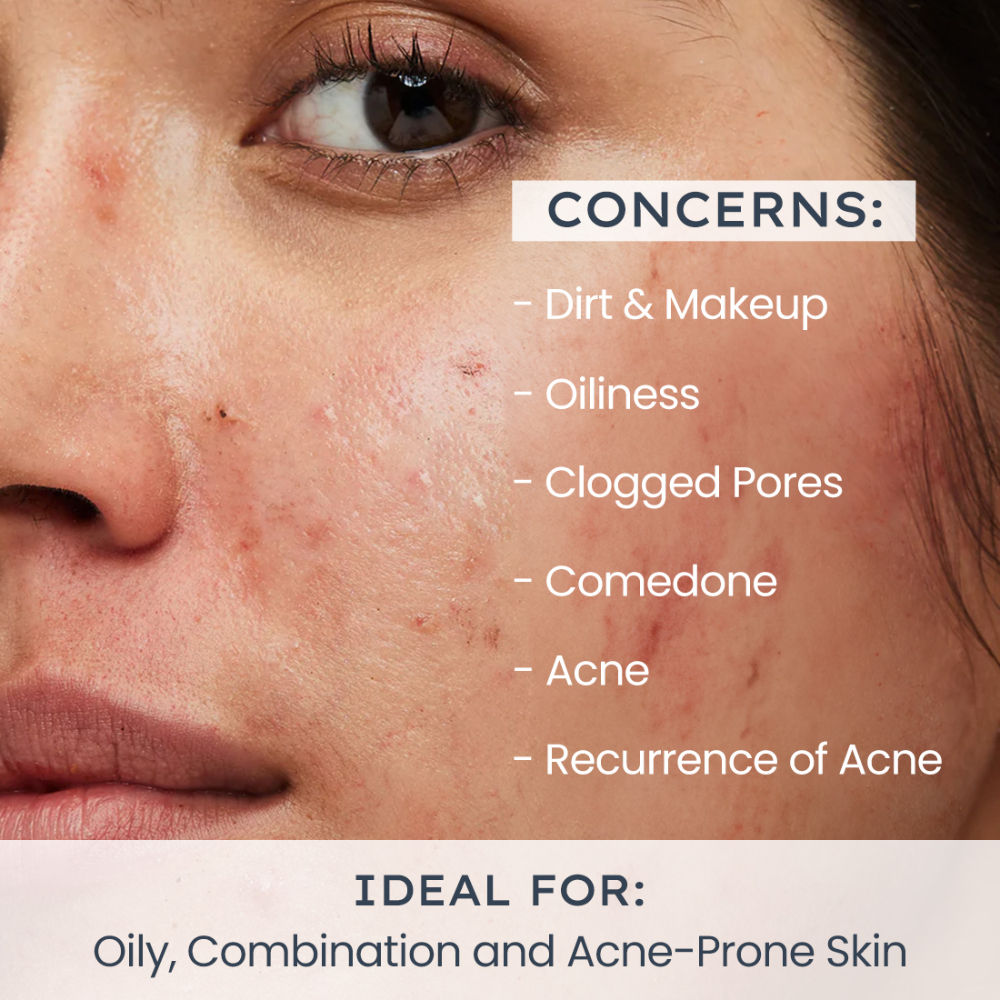 Oil Control Daily Exfoliating Cleanser 2% AHA + BHA Salicylic Acid Face Wash For Oily Skin & Acne
