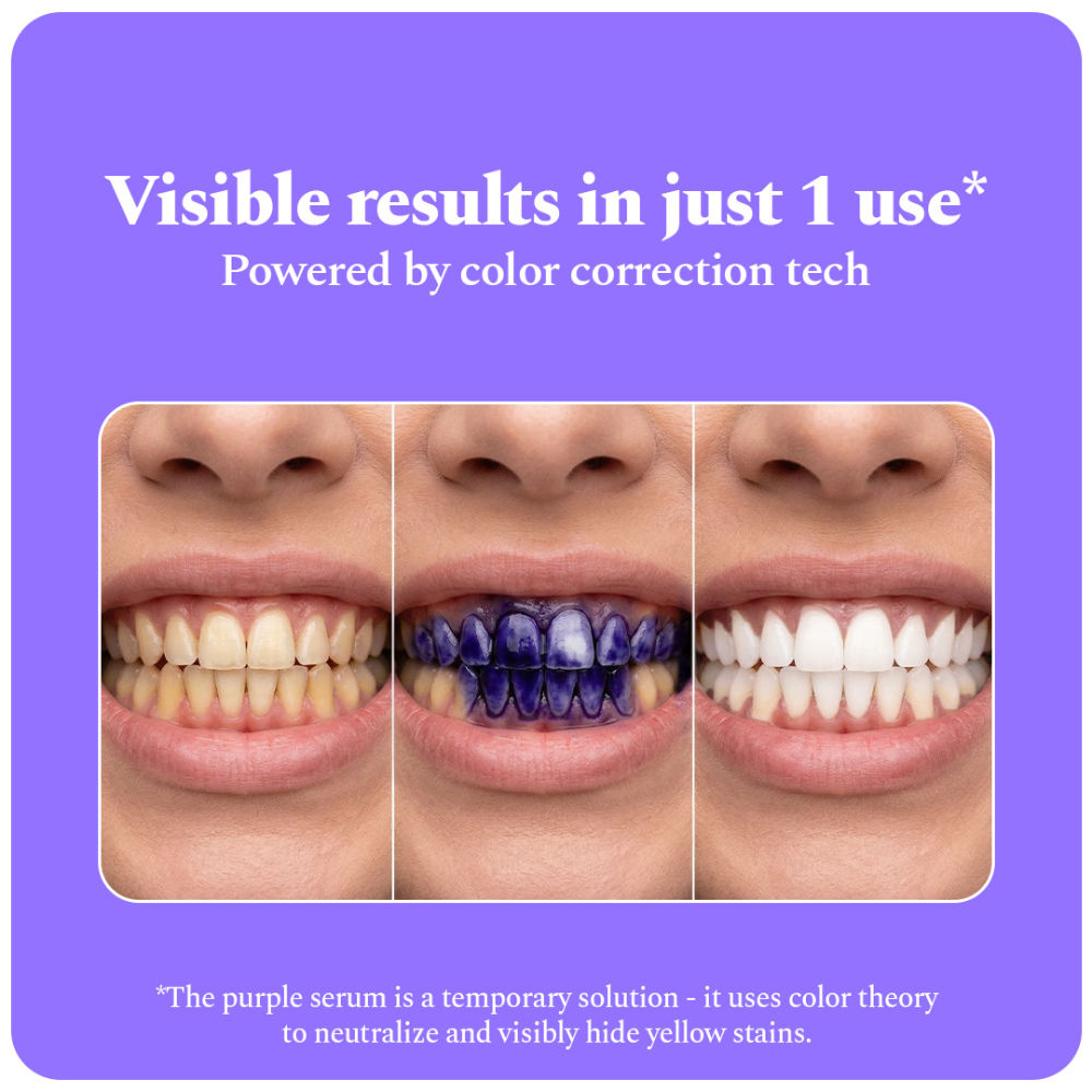 Purple Magic Teeth Whitening Serum