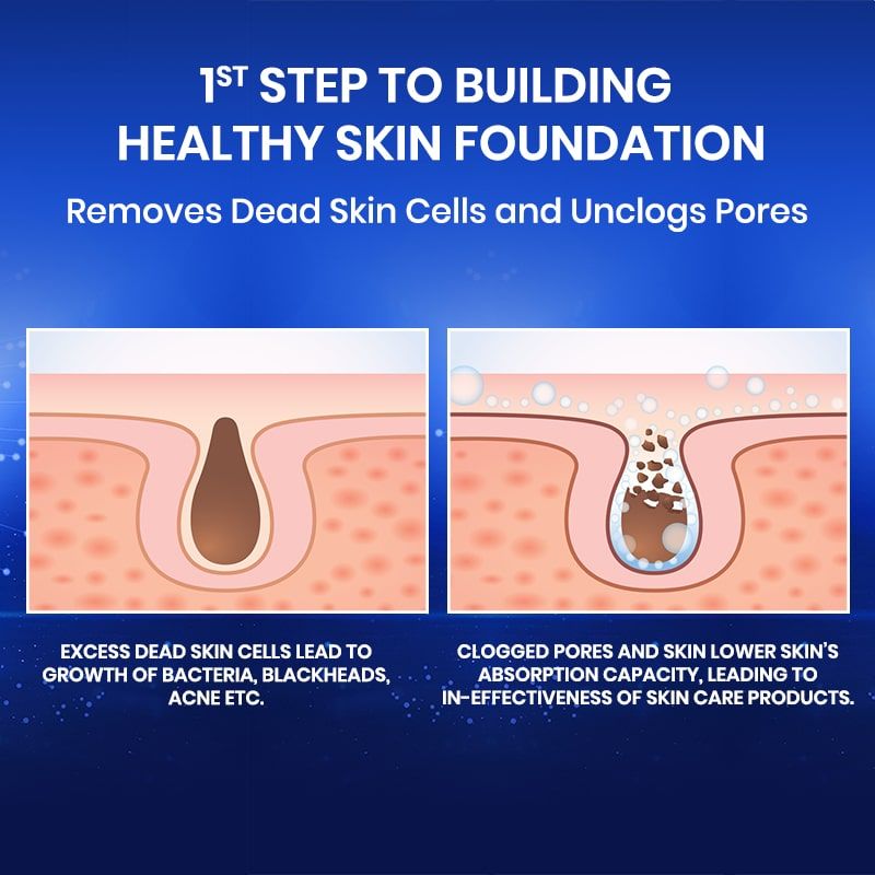 Bio-Renew Exfoliating Gel