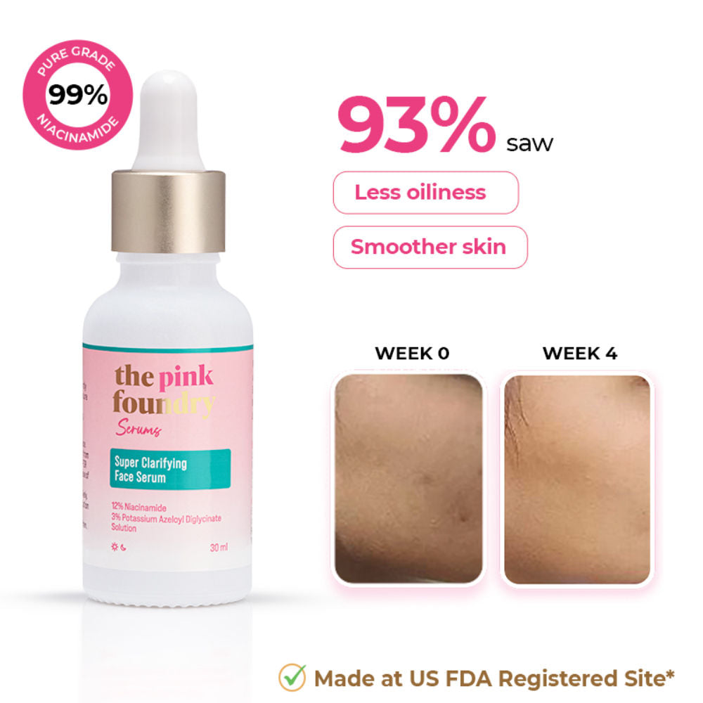 12% Niacinamide Serum - Evens Skin Texture, Controls Excess Oil & Refines Pores