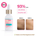 12% Niacinamide Serum - Evens Skin Texture, Controls Excess Oil & Refines Pores - 15ml