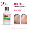 Acne & Oil Control Intense Face Serum with 2% Salicylic Acid