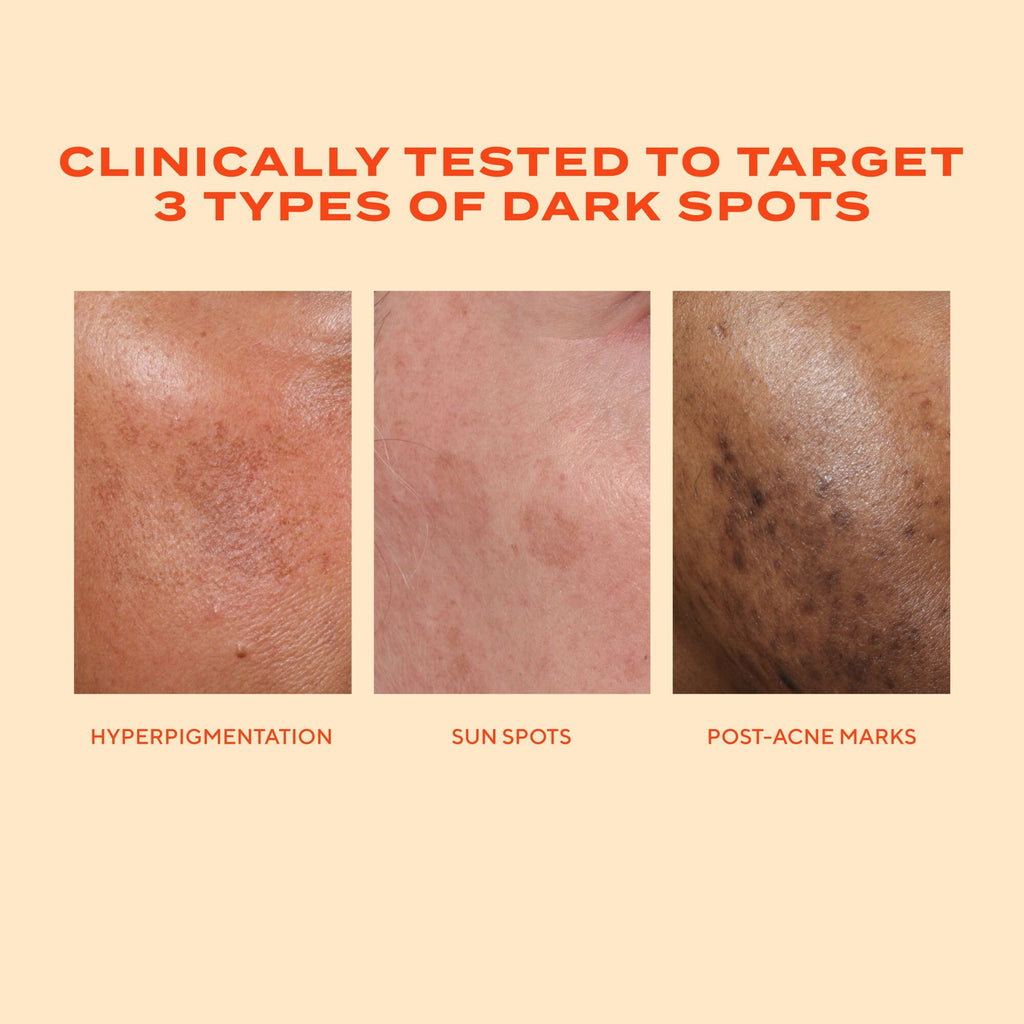 Rapid Dark Spot Correcting Serum