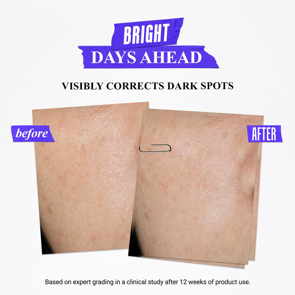 Clearly Corrective Dark Spot Solution With Activated C & Buffered Salicylic Acid
