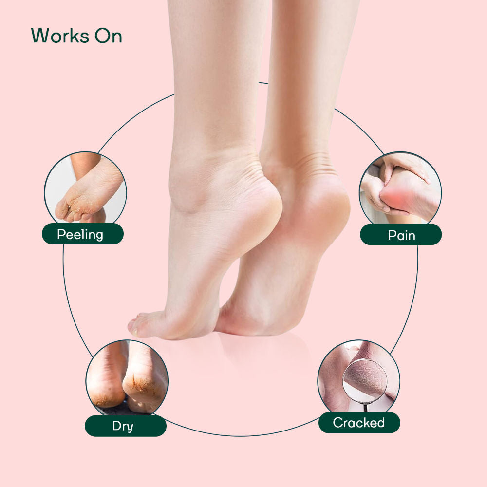 Silicone Gel Heel Foot Socks For Dry Hard Cracked Heels, Baby Soft Feet Repair Pad