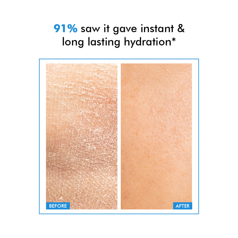 Hyaluronic Acid Lightweight Gel Moisturizer For Intense Hydration
