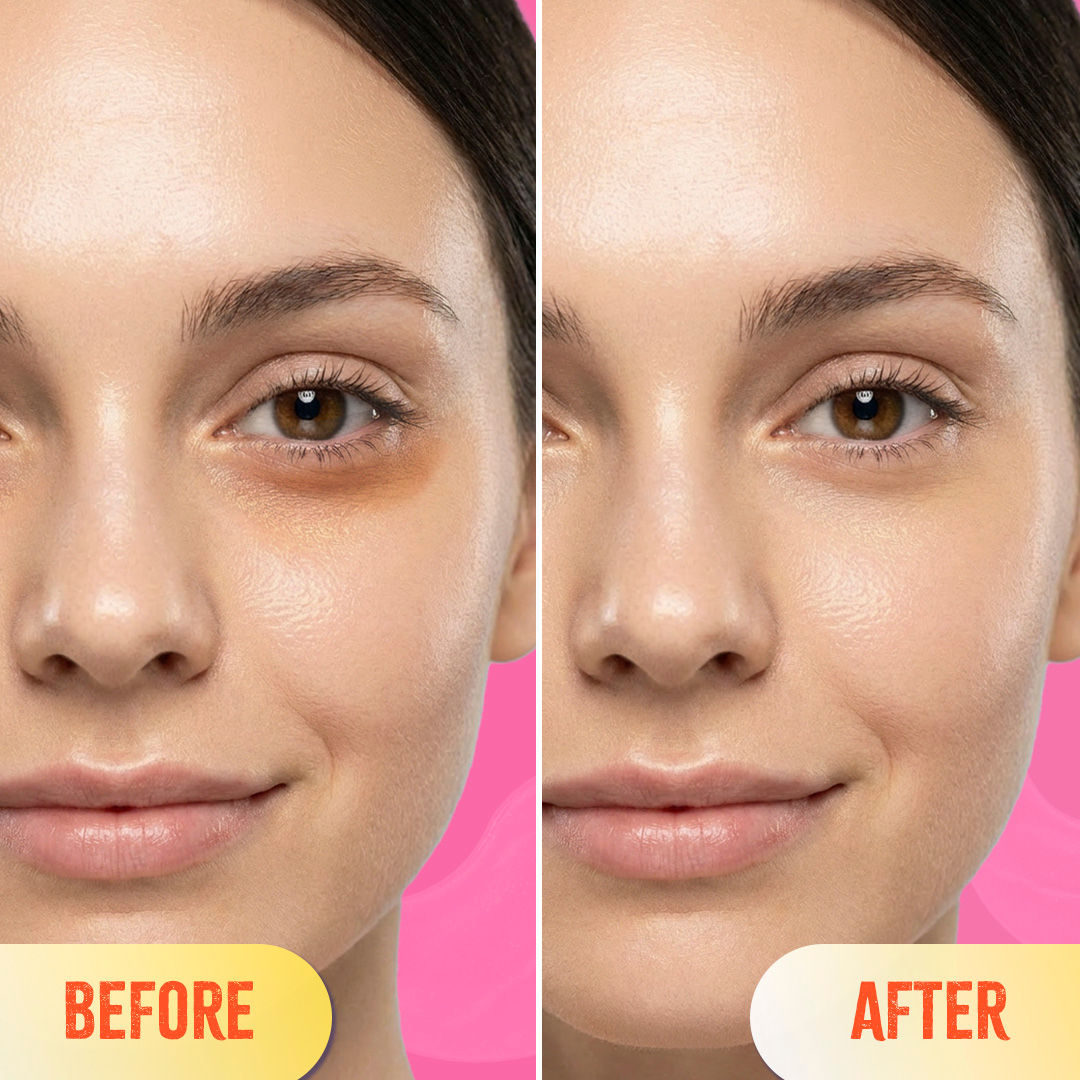Gold Hydrogel Under Eye Patches-Caffeine & Collagen For Dark Circles, Hydration & De-Puff